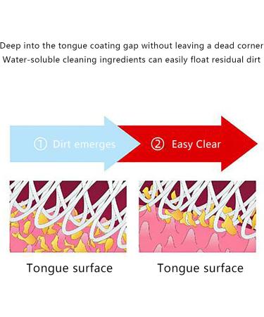Best Tongue Cleaner Brush Set with Gel - Eliminate Bad Breath & Freshen Breath | Mint Fragrance - Buy Online on GoSupps.com