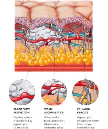 Shock Wave Therapy Device for ED & Pain Relief | Extracorporeal Shock Wave Massager for Muscle Pain Relief - Buy Online on GoSupps.com