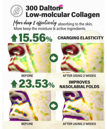 CKD Retino Collagen Gua Sha Lifting Serum - Puffiness Relief & Firming Gel with Stainless Steel Roller - 1.69 fl. oz - International Shipping Available - Buy Online on GoSupps.com
