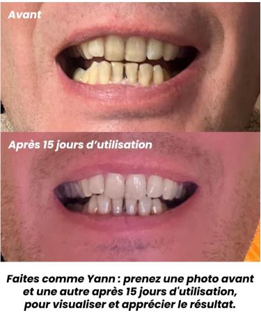 BOTAN Cosmetics - Whitening Toothpaste with Organic Activated Charcoal - 99.39% ingredients of natural origin - 75 ml - Made in France - Buy Online on GoSupps.com