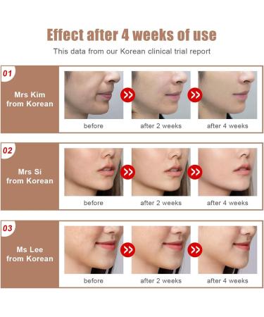 Aimanfun Intelligent Remote Control Sliming Facial Lifting Belt - Red Blu-Ray Firming Face Slimming Instrument for Portable V-Face Lift - Buy Online on GoSupps.com