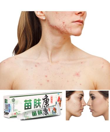 Herbal Anti-Itch Cream for Psoriasis, Dermatitis, Eczema - Multicolor, One Size - Buy Online on GoSupps.com
