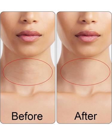 10pcs Bandes Lifting Cou Bandes Adh sives pour Cou Tr s lastiques Respirantes Imperm ables pour Double Menton et Peau Affaiss e R duction Rides et Raffermissement(Blanc Cass ) - Buy Online on GoSupps.com