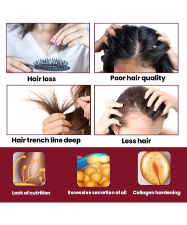 JITASHWA Hair Growth Foam Hair Regrowth Treatment for Women & Men Hair Regrowth Scalp Foam Hair Loss Solution Hair Thickening Product - Buy Online on GoSupps.com