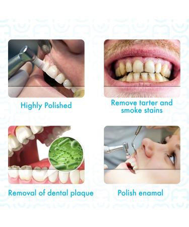 20X Mint Medium Tooth Polish & Stain Remover Cups - Achieve a Bright Smile | International Shipping Available - Buy Online on GoSupps.com