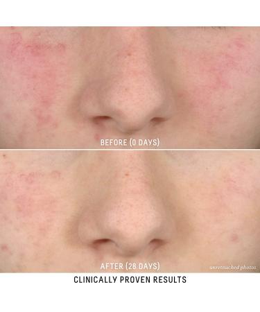 Biossance Squalane + Probiotic Gel Moisturizer - Gentle Formula for Calming Redness, Rosacea, and Pores - 1.6 oz - Buy Online on GoSupps.com