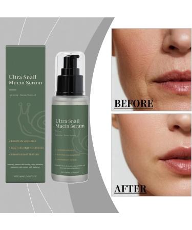 Gel - 100ml Delicate Neck and Body Care Beauty Home Travel Women - Buy Online on GoSupps.com