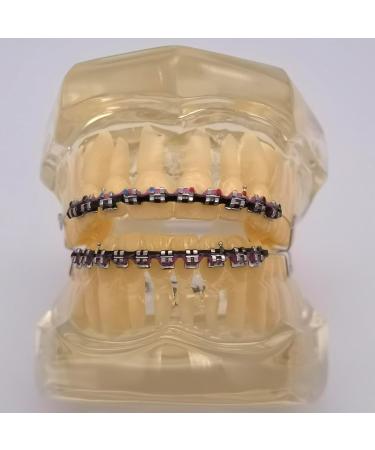 Funny and Fashion Fake Braces Kit With Two Color Teeth Braces Power Chain - Easy Stall For Orthodontist Dental Student Practice (No61-Black&Purple) - Buy Online on GoSupps.com
