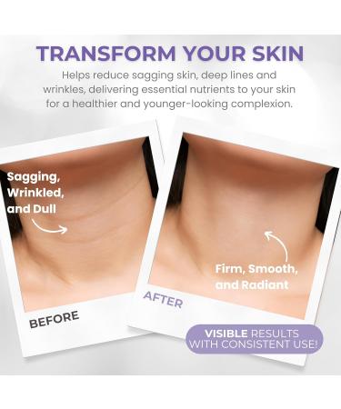 Neck Firming Cream - Anti-Aging & Tightening Moisturizer for Turkey Neck - Lift & Hydrate Skin - 1.7 oz Premium Skincare - Buy Online on GoSupps.com