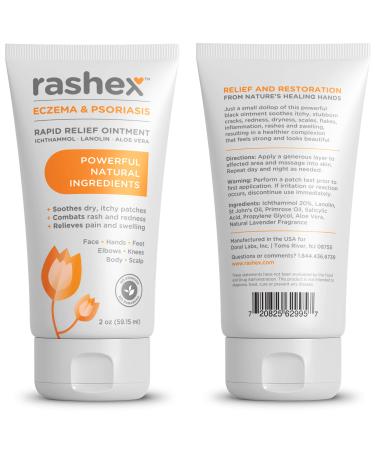 Rashex Eczema & Psoriasis Treatment Ointment with Black Ichthammol 20% - Fastest Relief - 2 Ounce Tube