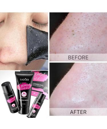 Blackhead Remover Skincare Set Black Head Remover for Face Pore Strips for Blackheads Lead Out - Blackhead Remover Cream - Pore Minimizer for Blackheads Dirt Acne Oily Skin Pores Shrinking - Buy Online on GoSupps.com