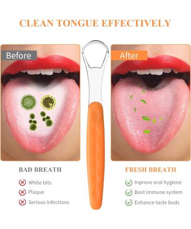 Vesaneae Tongue Cleaner Set 2 | Stainless Steel Tongue Scraper with Travel Case | Oral Hygiene for Bad Breath | Narrow Head Design - Buy Online on GoSupps.com
