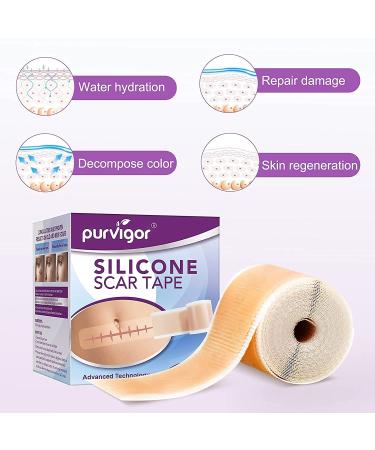 Medical Grade Silicone Scar Sheets - 1.6 x 60 Reusable Gel Tape for Acne, C-Section, Keloid Surgery Scars Treatment - Buy Online on GoSupps.com