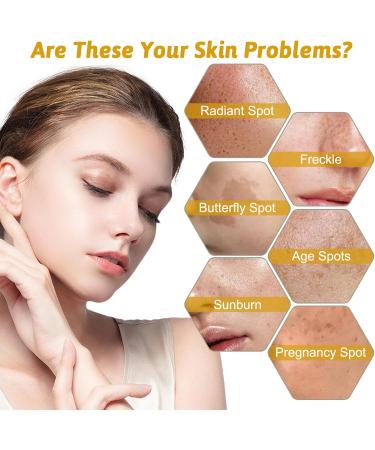 Niacinamide Face Serum 10% Niacinamide Serum + 1% Zinc Serum Face Moisturiser High Strength Vitamin Nourish Skincare Anti Aging Dark Spot Remover for Face Glow Skin Correcting (30ML) - Buy Online on GoSupps.com
