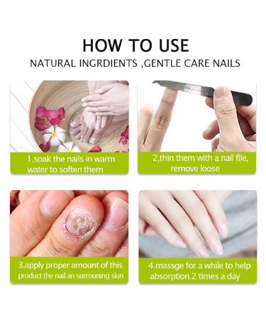 2PCS Nail Repair Essence Cream - Restores Discolored/Damaged Nails - Toe Beauty Cream for Toenail Care - Buy Online on GoSupps.com