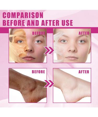 Exfoliant Yellow Peeling Oil - Extra Strong Chemical Exfoliant for Face & Body Reduces Rough Skin & Dullness Removes Dead Skin Cells - Buy Online on GoSupps.com