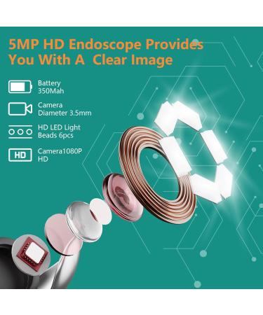 1080P Wireless Ear Wax Removal Kit Camera | Visual Ear Cleaner Endoscope with 6 Lights | WiFi Otoscope for Earwax Removal Tool | Anti Fall Off Eartips | Ear Cleaner - Black - Buy Online on GoSupps.com