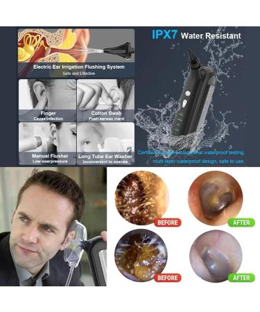 Buy Dotmalls Earclean Pro & Hilpert Electric Ear Wax Remover - 4 Pressure Modes | International Shipping Available - Buy Online on GoSupps.com