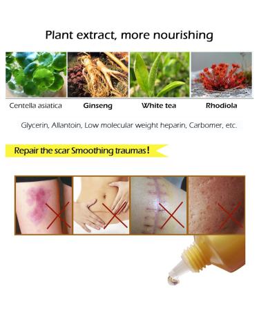 Symeas Scar & Acne Removal Cream - Effective Treatment for Stretch Marks Keloid Skin & Burns - 30g - Buy Online on GoSupps.com