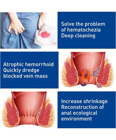 Hemorrhoid Cream - Fast Relief for Itching and Swelling - Ideal for Drivers, Office Workers and Pregnant Women - Buy Online on GoSupps.com