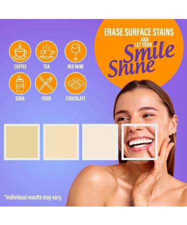 GuruNanda Premium Teeth Whitening Kit with Wired LED Light & Whitening Pen Works with iPhone & Android Helps Remove Surface Stains from Coffee Food Soda - Buy Online on GoSupps.com