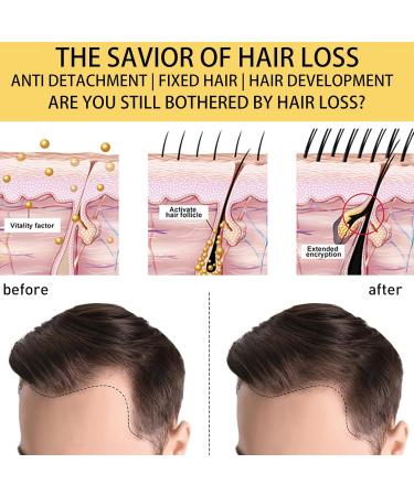 Ginger Hair Care Lotion Hair Growth Spray Ginger Hair Growth Oil Anti Hair Loss Trengthen Hair Roots Hair Care Lotion for Men and Women Thicken and Strengthen for Hair Regrowth - Buy Online on GoSupps.com