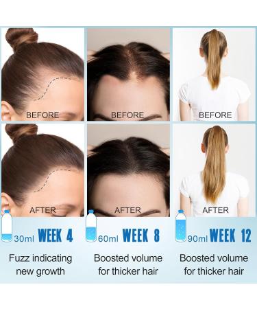 Rosemary Oil for Hair Growth Hair Growth Oil Diluted Rosemary Oil and Hair Serum for Dry Damaged Hair Proven Hair Loss Treatment & Hair Thickening Products Gifts for Women Men Appl - Buy Online on GoSupps.com