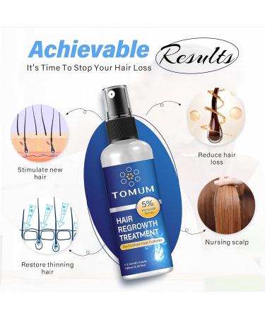 5% Minoxidil Hair growth Spray for Women and Men: Anti Hair Loss Treatment for Hair Regrowth Extra Strength Scalp Solution Thicken Strengthen Longer Hair 100Ml - Buy Online on GoSupps.com
