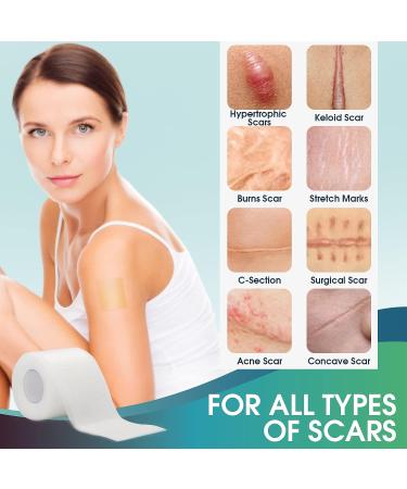 Silicone Scar Sheets Roll - 1.6 x 120 - 3M Clear Scar Tape for Scars Removal - Reusable Strips for Keloid, C-Section, Surgery, Burn, Acne - Elastic Bandage Treatment - Buy Online on GoSupps.com