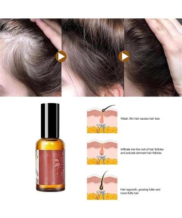 Avocado and Peppermint Hair Oil Avocado Peppermint Hair Growth Oil Avocado Oil and Peppermint Oil for Hair and Beard Growth - Buy Online on GoSupps.com