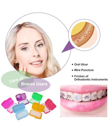 12 Pack Colorful Orthodontic Wax for Braces with Case - Food Grade Relief Wax in 10 Colors - Comfortable and Tasteless for Pain Relief - Buy Online on GoSupps.com