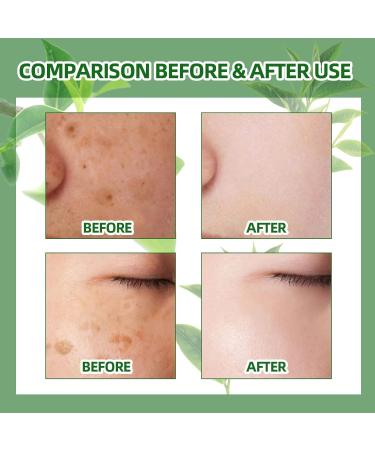 Green Tea Brightens and Fades Spots Water Brightens Skin Fades Dull Pigments Brightens Complexion and Tones Skin 60ml - Buy Online on GoSupps.com