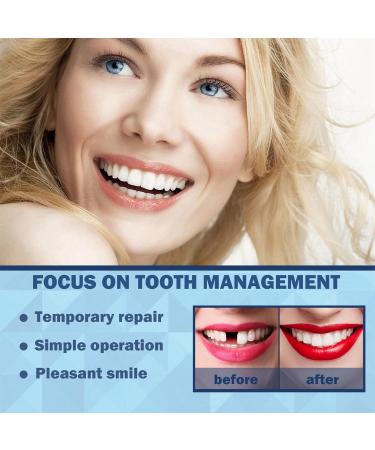 DIY Temporary Tooth Filling Kit for Missing or Broken Teeth - Moldable False Teeth Beads (2pcs) - Buy Online on GoSupps.com