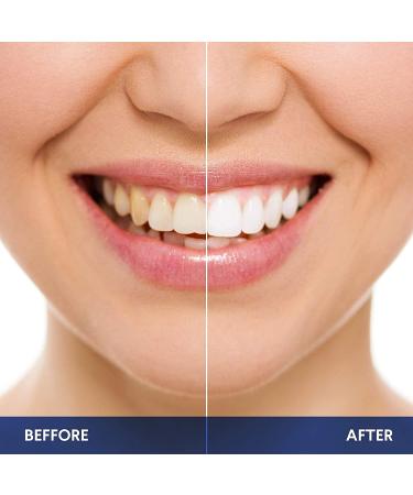 LUELLI Teeth Whitening Kit - 5X LED Tooth Whitener with 12ml Serum for Bright Smile - Buy Online on GoSupps.com