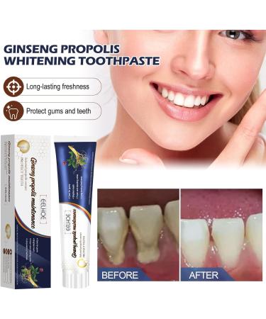 Toothpaste for loose teeth Toothpaste for loose teeth care Ginseng Propolis Protection Toothpaste Deep Cleansing Care Toothpaste - Buy Online on GoSupps.com