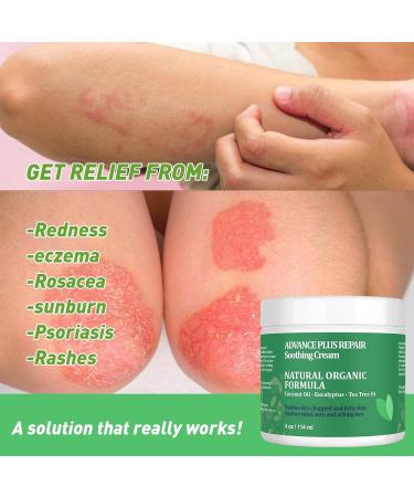 Tea Tree Oil & Manuka Honey Balm | Extra Strength Jock Itch Cream & Eczema Ointment | Natural Moisturizer for Dry & Sensitive Skin - 2 Fl Oz - Buy Online on GoSupps.com