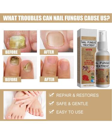 Repair Liquid Nail Conditioner for Safe & Easy Protection - Buy Online on GoSupps.com