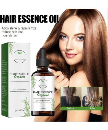 Shelure Hair Growth Oil Shelure Rosemary Hair Oil Organic Shelure Hair Regrowth Treatment Oil Hair Regrowth Extract Oil Get Luscious Locks With Shelure Hair Regrowth Oil - Buy Online on GoSupps.com