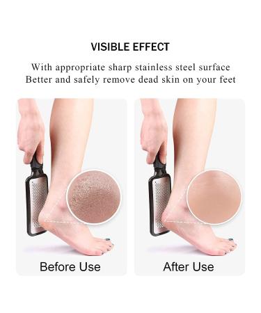 SetSail Stainless Steel Foot File Callus Remover - Professional Pedicure Tool for Wet and Dry Feet - Foot Scrubber for Dead Skin Removal - Buy Online on GoSupps.com