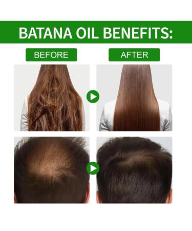 Batana Oil for Hair Growth - 100% Pure Organic Dr. Sebi Oil from Honduras | Stronger Thicker Longer Hair Enhances Radiance & Repairs Damage - Buy Online on GoSupps.com