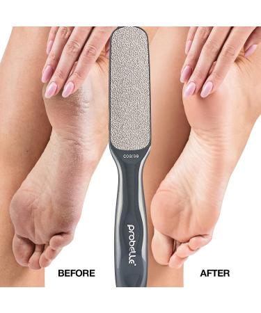 Probelle Double Sided Multidirectional Nickel Foot File Callus Remover - Instantly Reduce Calluses and Corns to Powder, Safe Tool (Dark Grey) - Buy Online on GoSupps.com