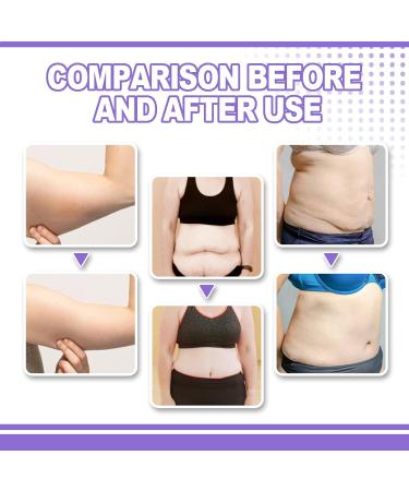 Lift and Firm Arm Cream Collagen Body Cream that Hydrates Collagen Firming Body Cream Firming Moisturiser Targets Wrinkles and Sagging for Tighter Firmer and Makes the Body Smoother - Buy Online on GoSupps.com