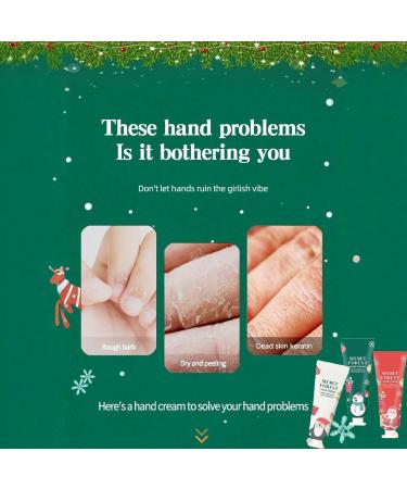  Alelyer Christmas hand cream set moisturizing and nourishing cream for dry cracked and flaky hands fast absorption Christmas gift for women and men - Buy Online on GoSupps.com