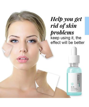  Youngwier Youngwier Facial Pore Reducer - Pore Shrinking | 1 oz Moisturizing and Firming Liquid for Oily and Blemish-Prone Skin - Buy Online on GoSupps.com