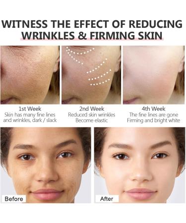 Double Retinol Serum for Face Retinol Serum High Strength for Face and Skin with Hyaluronic Acid Vitamin E Anti Aging Facial Serum Moisturizing Reduce Wrinkle Skin Repair Face Serum - Buy Online on GoSupps.com