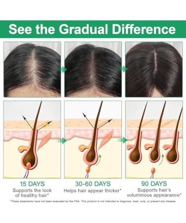  Generisch Hair Growth Serum - 3% Rosemary & 3% edensyl & 2% NaGain Hair Growth Serum with Rosemary Aloe Vera Coconut Oil & Shea Butter Hair Serum for Hair - Buy Online on GoSupps.com