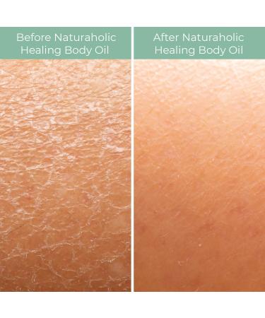 Rice Bran Beauty Healing Body Oil - Vegan Skin Moisturizer & Rejuvenator (8 oz) - Shop Internationally - Buy Online on GoSupps.com