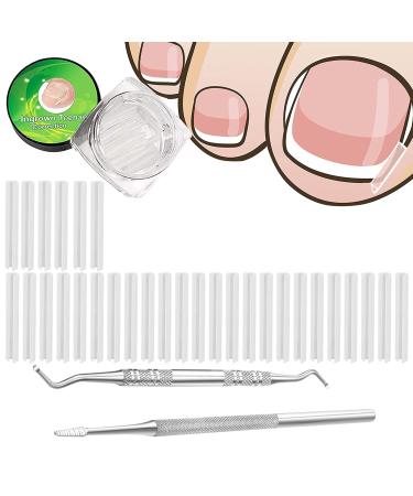 (30+2) Pack Ingrown Toenail Correction Treatment Kit, 30PCS Ingrown Toenail Corrector Strips Brace Ingrown Toenail Pedicure Tool Toenail Correction Patch with 2PCS Ingrown Toenail Lifter and File silver-32pcs