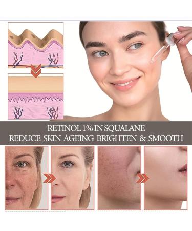 Retinol 1% In Squalane 30ml Retinol Serum for Face & Hyaluronic Acid Serum for Face Anti Aging Serum for Face Brightening Face Serum for Women Reduce Fine Lines Wrinkles Vegan Skincare - Buy Online on GoSupps.com
