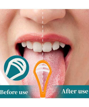 Tongue Brush Set - 5 Pack 2-in-1 Tongue Cleaner & Scraper for Fresh Breath | Silicone Tongue Brush for Adults & Kids - Buy Online on GoSupps.com